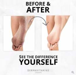 Złuszczające skarpetki do stóp, peeling WITAMINY ABCEK, Dermavitamins 1 szt